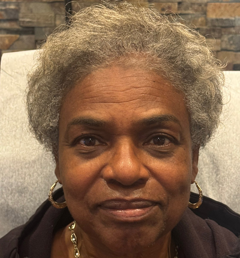 TED® Hair Treatment Final Result