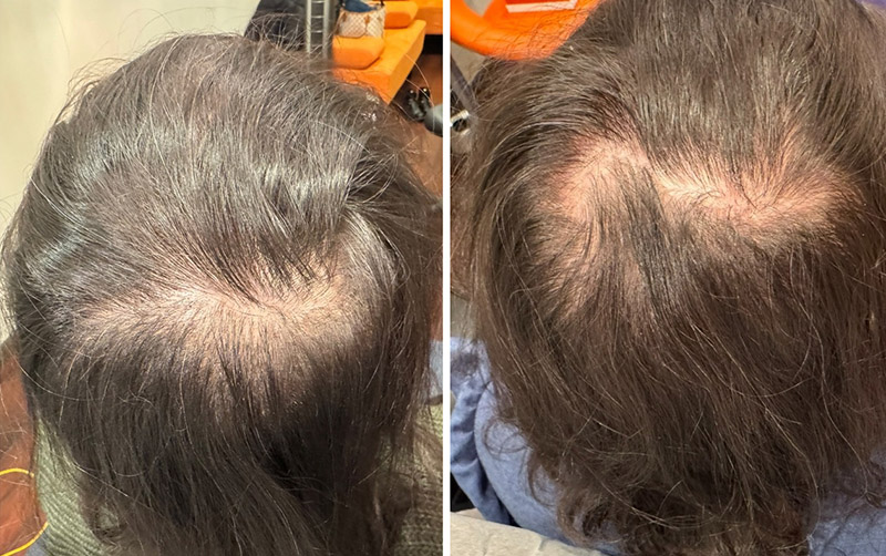 TED® Hair Treatment Before & After