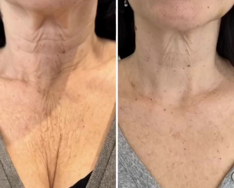 Morpheus Before & After