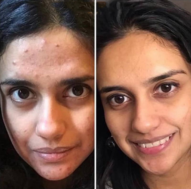 Morpheus Before & After